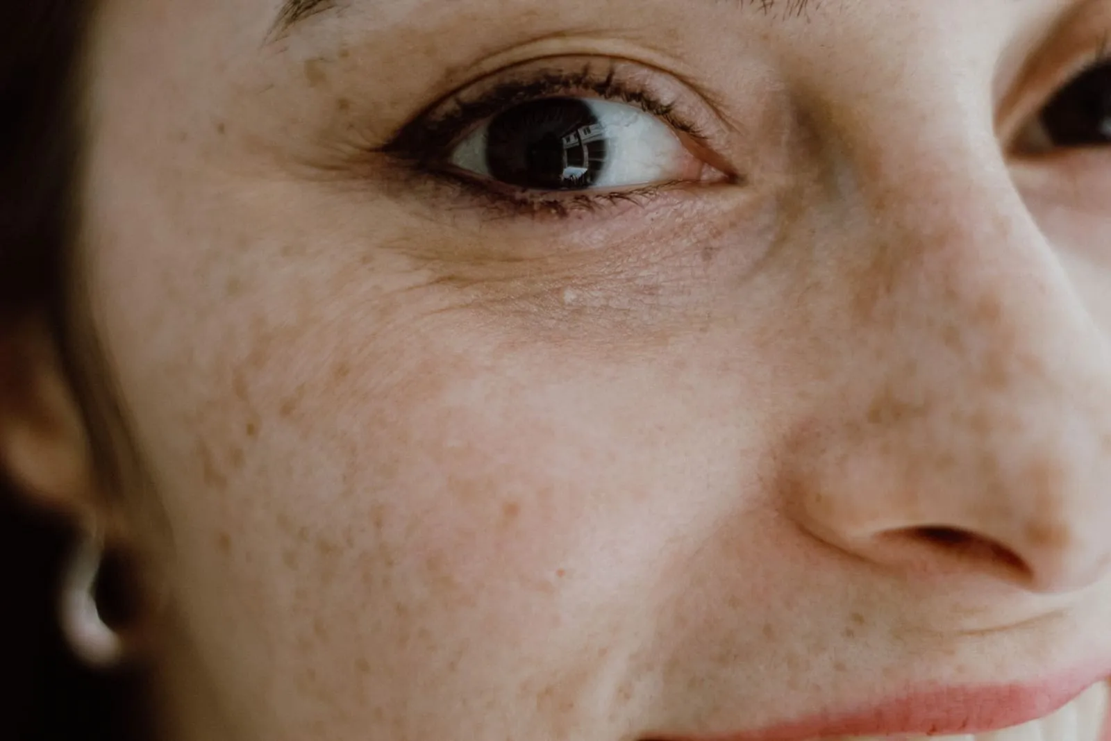A close-up of a face in soft daylight, freckles and fine lines visible